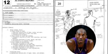 Kobe Bryant's autopsy report PHOTO/X, formerly Twitter